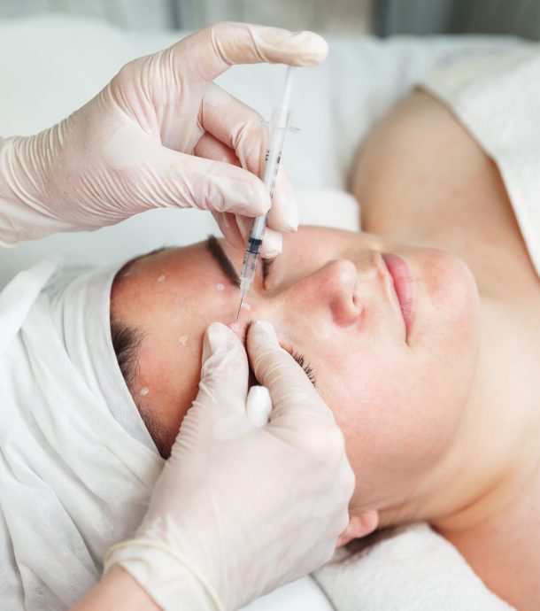 Cosmetic procedure for correction of cheekbones with botox injections